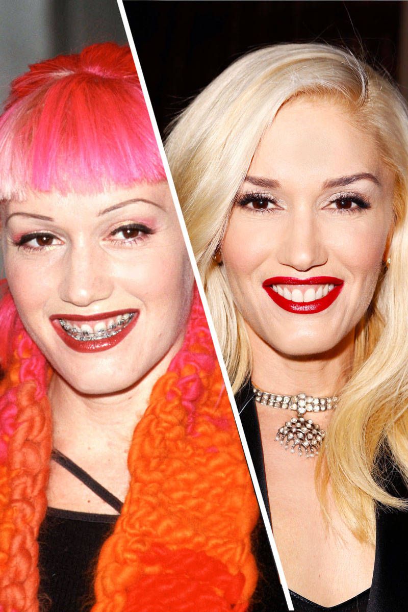Gwen-Stefani Top 10 Celebrities with a Gummy Smile