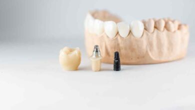 Dental Implant Regulations