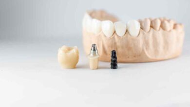 Is It Safe to Get Dental Implants in Turkey: Understanding Safety Standards And Qualified Specialists 58 Dental Implant Regulations