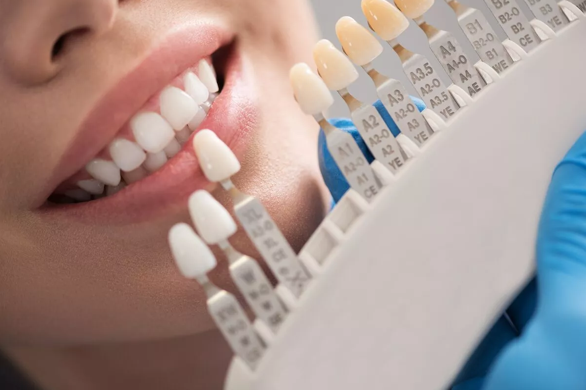 Dental Implant Regulations
