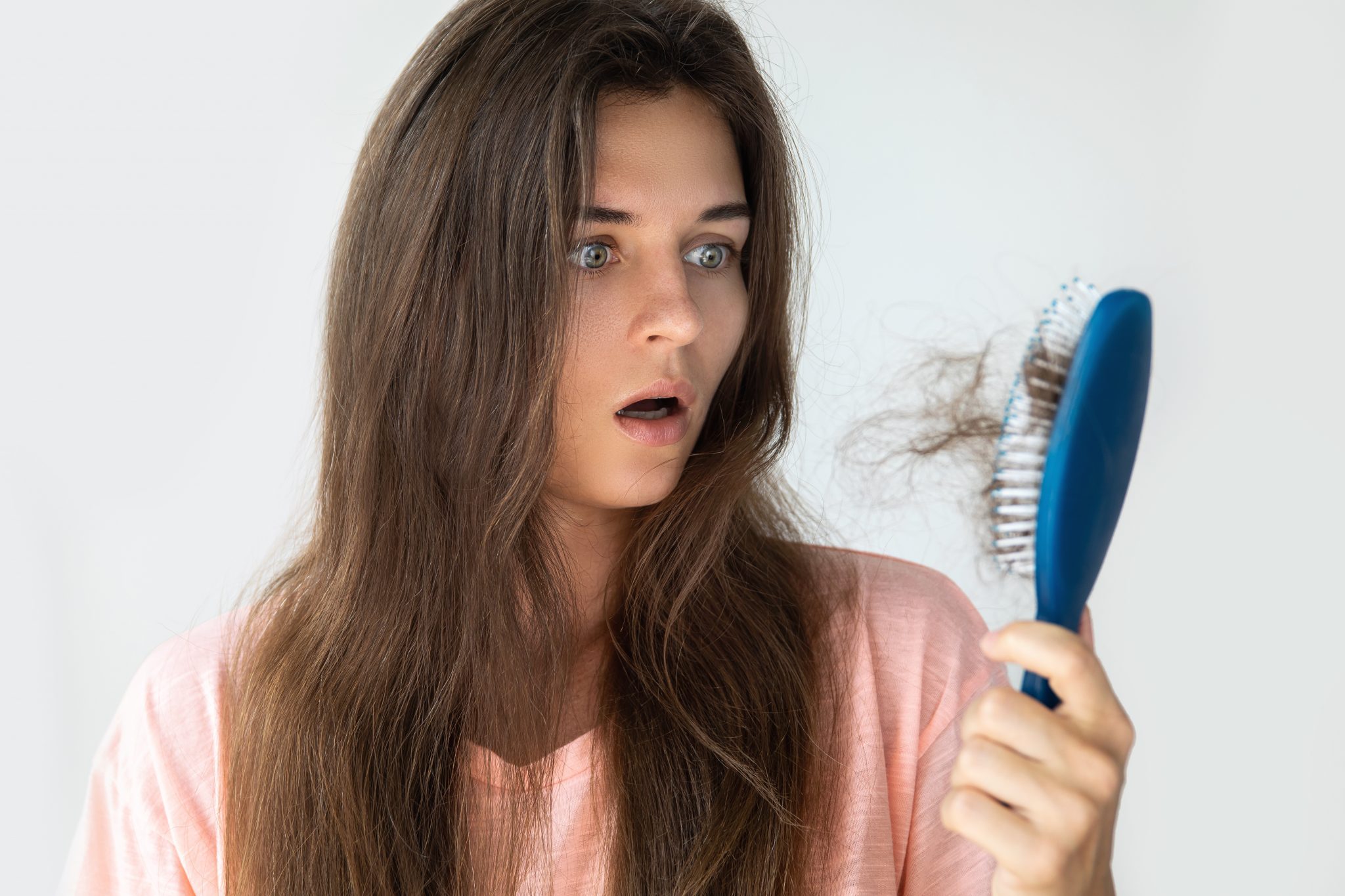 Top 7 Causes of Hair Loss: Symptoms and Causes of Alopecia 4 Hormonal Changes Top 7 Causes of Hair Loss: Symptoms and Causes of Alopecia - 4