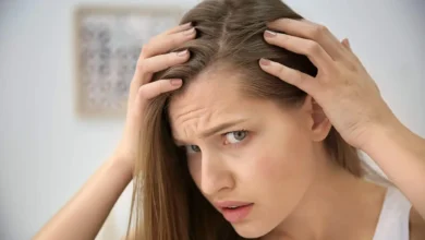 Top 7 Causes of Hair Loss: Symptoms and Causes of Alopecia 72 hair loss Top 7 Causes of Hair Loss: Symptoms and Causes of Alopecia - 72